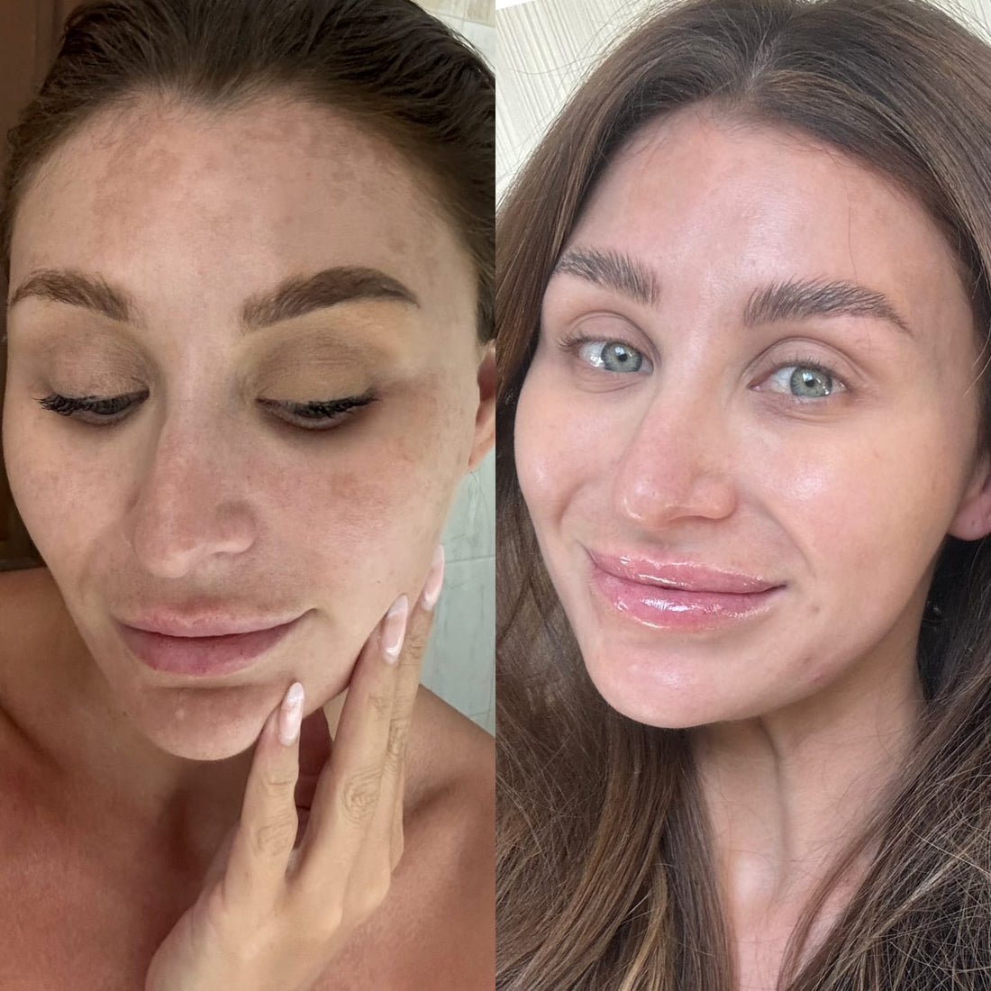 Three clinically-backed actives. One glow.